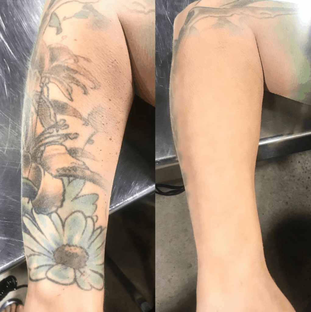 airbrush tattoo coverage kett costmetics